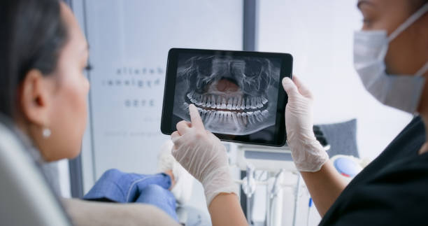 Licensed Wisdom Tooth Removal service in Fredericksburg, IA - Smile Center Dentistry